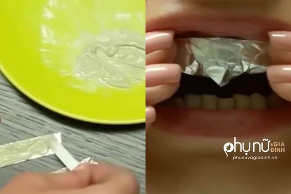 Cách làm trắng răng tại nhà sau 2 phút với một miếng giấy bạc - Ảnh 2