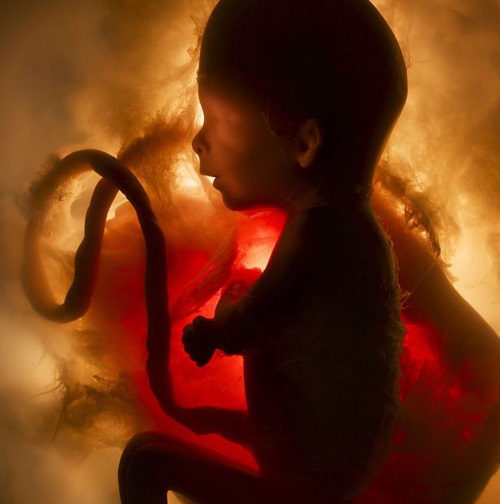 5 dấu hiệu báo thai nhi đang “kêu cứu” từ trong bụng mẹ - Ảnh 3