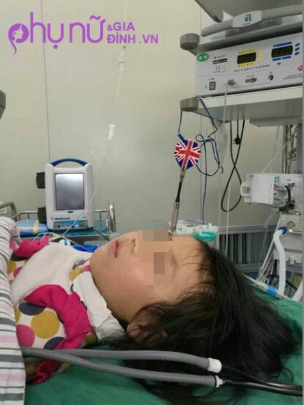 Bé gái 6 tuổi bị anh trai ném phi tiêu đâm vào đầu - Ảnh 3
