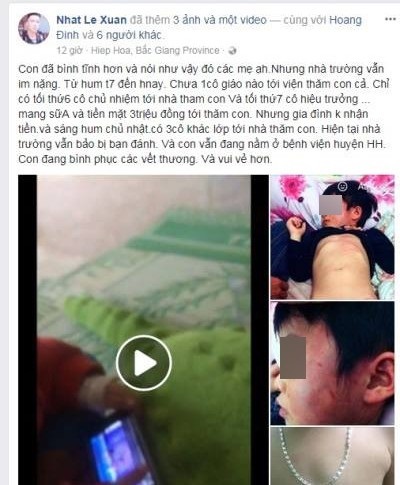 Bé gái 4 tuổi bầm tím khắp người nghi bị bạo hành: Cô giáo chủ nhiệm thừa nhận bản thân sơ suất - Ảnh 1 Bé gái 4 tuổi bầm tím khắp người nghi bị bạo hành: Cô giáo chủ nhiệm thừa nhận bản thân sơ suất - Ảnh 1