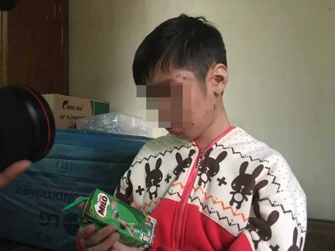 Thắt lòng lời kể của bé trai 10 tuổi bị bố và mẹ kế bạo hành tàn nhẫn - Ảnh 1 Thắt lòng lời kể của bé trai 10 tuổi bị bố và mẹ kế bạo hành tàn nhẫn - Ảnh 1