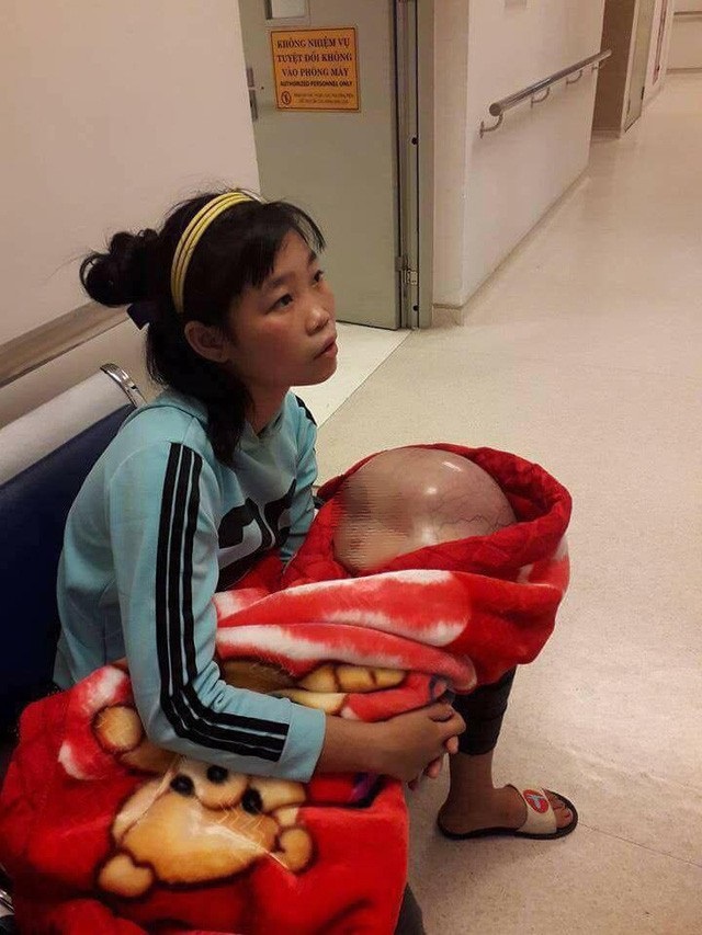 Bé trai mắc não úng thủy ở Thanh Hóa qua đời, nhiều nhà hảo tâm khóc vì xót xa thương cảm - Ảnh 2 Bé trai mắc não úng thủy ở Thanh Hóa qua đời, nhiều nhà hảo tâm khóc vì xót xa thương cảm - Ảnh 2