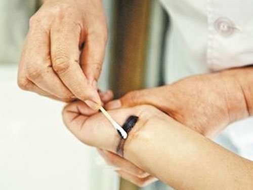 Thấy gia đình lâm vào đường cùng, bé trai bôi mực vào tay nhằm giấu bệnh để cha mẹ đừng lo lắng - Ảnh 2 Thấy gia đình lâm vào đường cùng, bé trai bôi mực vào tay nhằm giấu bệnh để cha mẹ đừng lo lắng - Ảnh 2