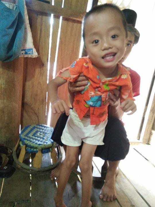Bị mẹ tìm mọi cách phá bỏ từ trong bào thai, bé trai H’Mông 5 tuổi khuyết tật vẫn khát khao ước mơ đến trường - Ảnh 1 Bị mẹ tìm mọi cách phá bỏ từ trong bào thai, bé trai H’Mông 5 tuổi khuyết tật vẫn khát khao ước mơ đến trường - Ảnh 1