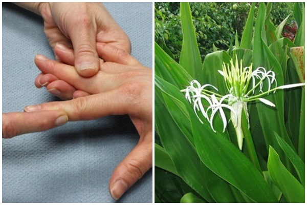 Trị bong gân ngón tay bằng đắp thảo dược tự nhiên