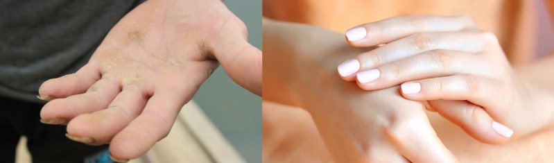 Cách làm mềm da tay bị chai đơn giản và tác dụng được nhiều chị em yêu thích nhất