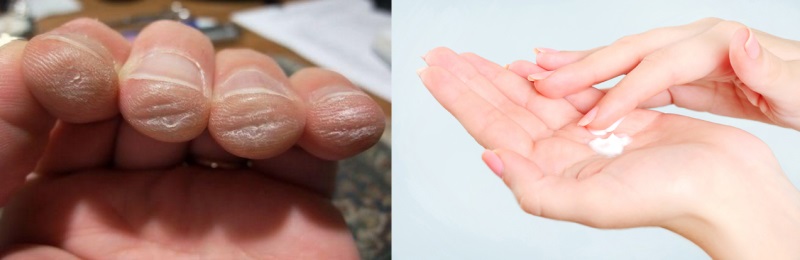 Sử dụng các sản phẩm dưỡng ẩm da, giữ da tay luôn mềm mại, không bị khô, sần