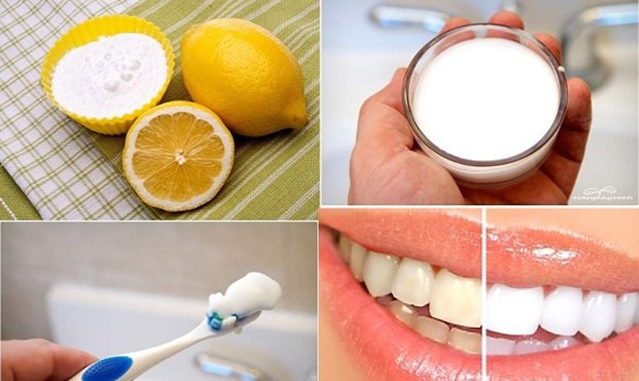 Cách làm trắng răng nhanh bằng Baking soda và nước cốt chanh