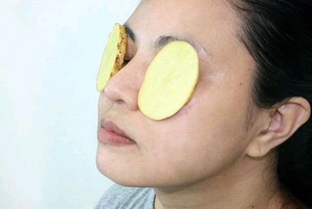 Cách trị thâm quầng mắt đơn giản với khoai tây