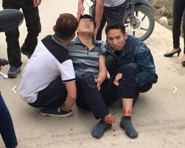 Mặc kệ còi báo hiệu, người đàn ông vẫn cố tình băng qua đường ray tàu hỏa và cái kết ‘đắng’ - Ảnh 5