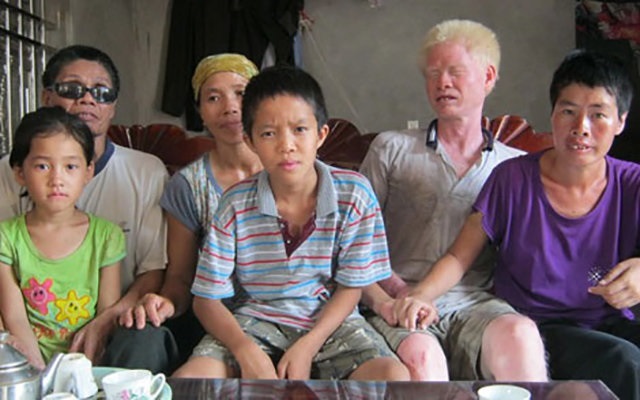 Chuyện tình xúc động của cựu binh mù nhiễm chất độc da cam có hai người vợ là chị em ruột - Ảnh 4 Chuyện tình xúc động của cựu binh mù nhiễm chất độc da cam có hai người vợ là chị em ruột - Ảnh 4