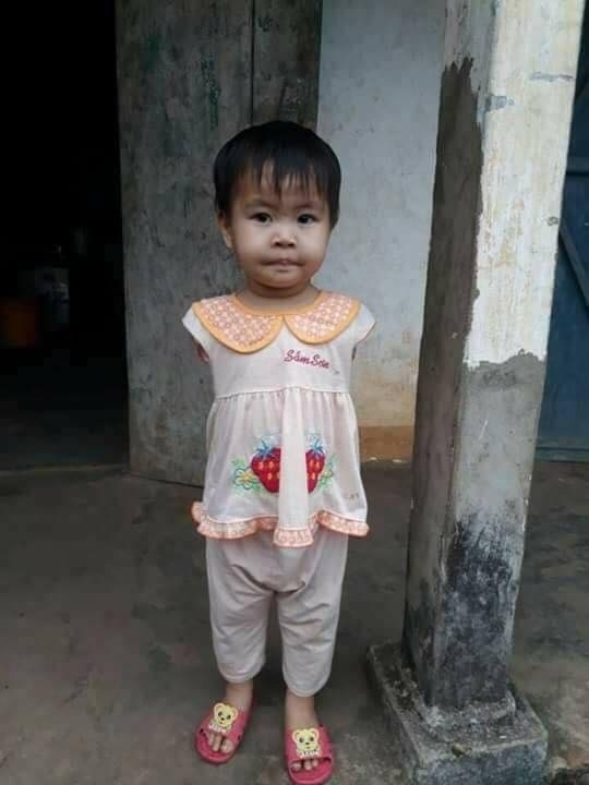 Cô bé 'chim cánh cụt' ngây ngô hỏi: 'Bà ngoại ơi, tay cháu đâu rồi? Bà lắp tay vào cho cháu tự xúc cơm ăn đi' - Ảnh 1 Cô bé 'chim cánh cụt' ngây ngô hỏi: 'Bà ngoại ơi, tay cháu đâu rồi? Bà lắp tay vào cho cháu tự xúc cơm ăn đi' - Ảnh 1