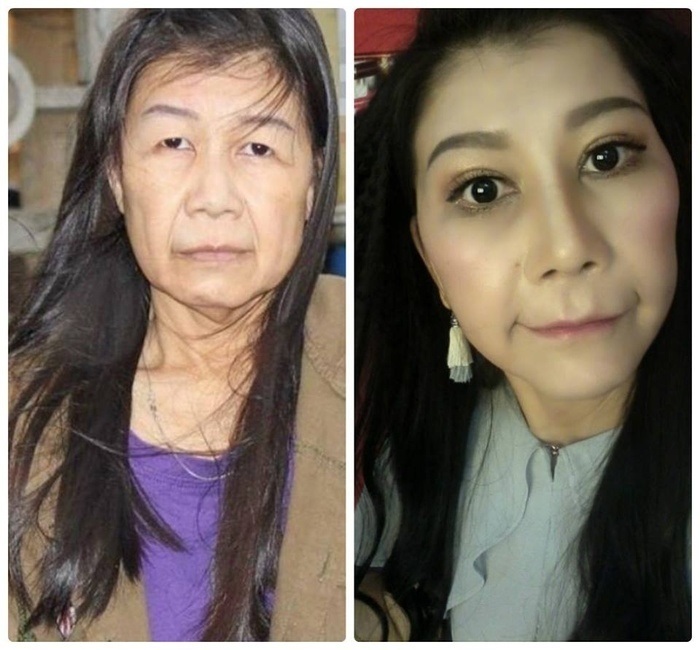 Cuộc đời đầy bi kịch của cô gái 22 tuổi sống trong thân hình bà lão 80: 'Mỗi lần nhìn vào gương là mỗi lần cay đắng' - Ảnh 3 Cuộc đời đầy bi kịch của cô gái 22 tuổi sống trong thân hình bà lão 80