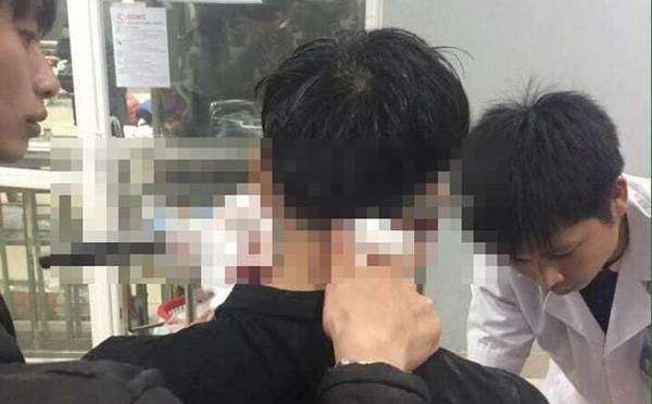 Thanh niên 19 tuổi bị dao nhọn đâm xuyên gáy ở Bắc Giang - Ảnh 1