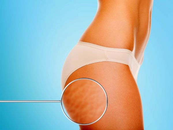 <a target='_blank' href='https://www.phunuvagiadinh.vn/cach-tri-da-san-vo-cam.topic'>Cách trị da sần vỏ cam</a> trả lại làn da mịn màng như em bé chỉ sau 1 tuần - Ảnh 1 Cách trị da sần vỏ cam trả lại làn da mịn màng như em bé chỉ sau 1 tuần - Ảnh 1