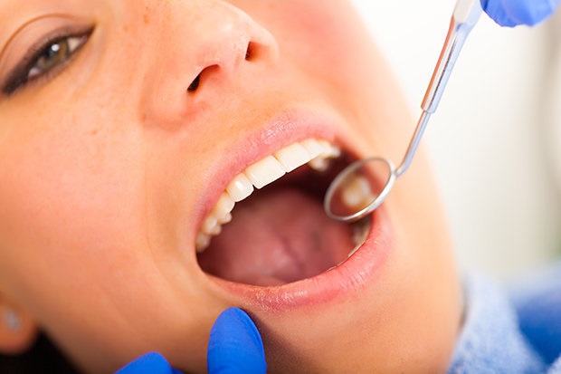 Cảnh báo: Thấy dấu hiệu này ở nướu, bạn có thể đã mắc bệnh tiểu đường - Ảnh 2 Cảnh báo: Thấy dấu hiệu này ở nướu, bạn có thể đã mắc bệnh tiểu đường - Ảnh 2