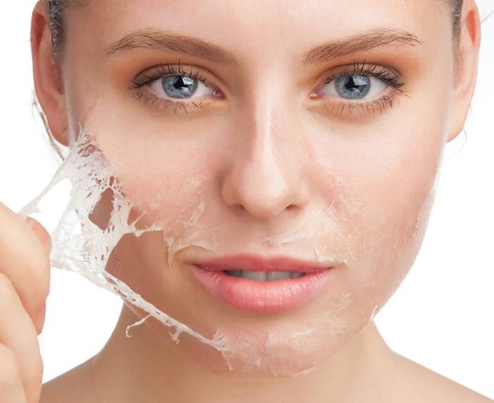 Điều trị sẹo rỗ mụn thâm lỗ chân lông to bằng cách nào là tốt nhất? - Ảnh 1 Thường xuyên tẩy tế bào chết để làm <a target='_blank' data-cke-saved-href='http://www.phunusuckhoe.vn/tag/se-khit-lo-chan-long' href='http://www.phunusuckhoe.vn/tag/se-khit-lo-chan-long'>se khít lỗ chân lông</a> và điều trị sẹo rỗ, mụn thâm hiệu quả.