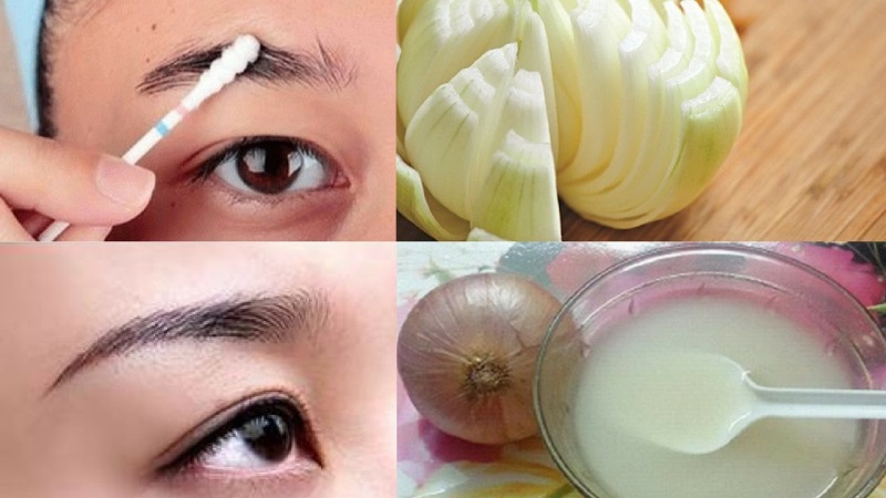 Lông mày thưa thớt, nhợt nhạt cũng hóa dày rậm sau 1 tuần nhờ loại củ quen thuộc này - Ảnh 2 Lông mày thưa thớt, nhợt nhạt cũng hóa dày rậm sau 1 tuần nhờ loại củ quen thuộc này - Ảnh 2