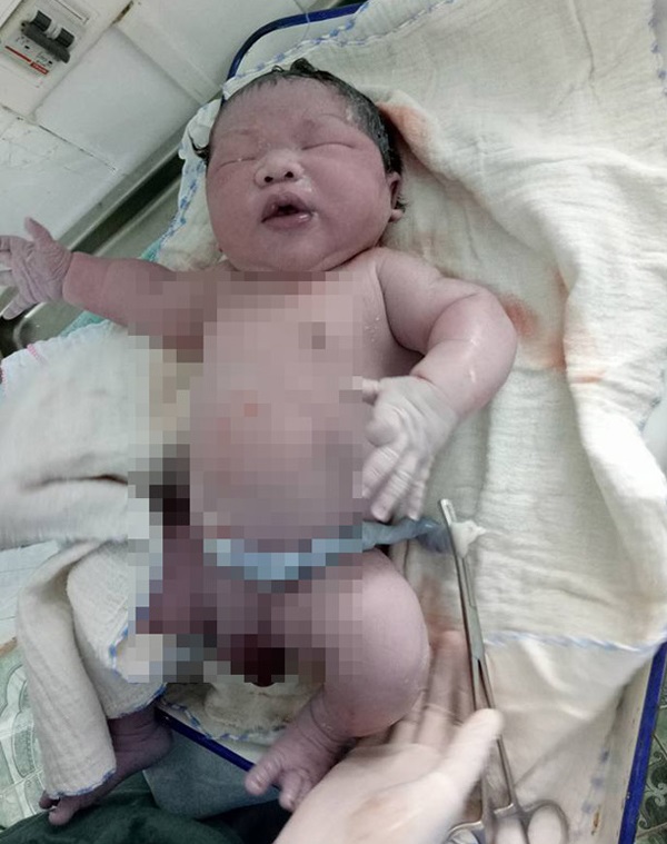 Bé trai sơ sinh 7,1 kg nặng nhất Việt Nam và những câu chuyện đằng sau hiếm người biết - Ảnh 1