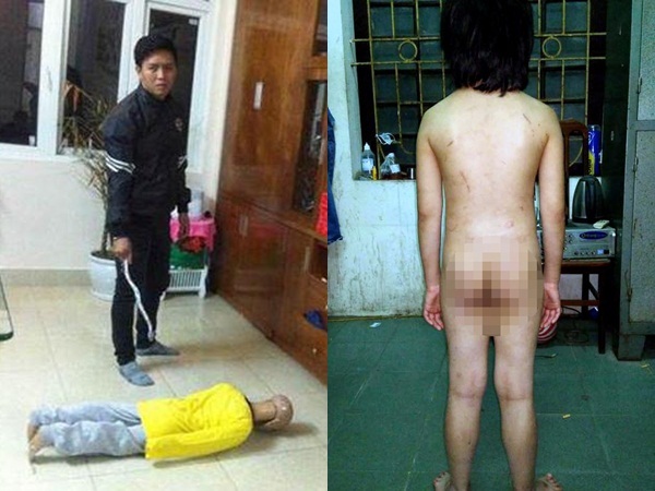 Bé trai 10 tuổi bị bạo hành gãy xương sườn, rạn sọ não chưa từng nhận một lời xin lỗi từ cha, mẹ kế - Ảnh 4 Bé trai 10 tuổi bị bạo hành gãy xương sườn, rạn sọ não chưa từng nhận một lời xin lỗi từ cha, mẹ kế - Ảnh 4