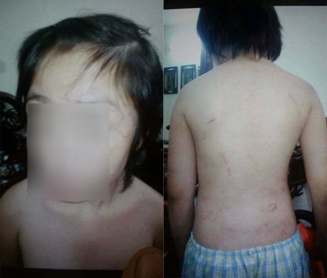 Rợn người trước lời khai của bố ruột bạo hành bé trai 10 tuổi gãy xương sườn, rạn sọ não: Dùng móc áo cuộn lại làm roi để đánh - Ảnh 4 Rợn người trước lời khai của bố ruột bạo hành bé trai 10 tuổi gãy xương sườn, rạn sọ não: Dùng móc áo cuộn lại làm roi để đánh - Ảnh 4