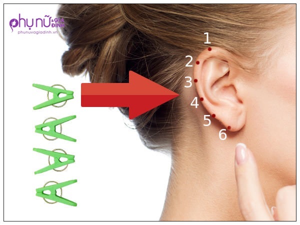 Kẹp điểm này ở tai, phương pháp chữa bệnh đang khiến cả thế giới 'phát sốt' - Ảnh 1 Kẹp điểm này ở tai, phương pháp chữa bệnh đang khiến cả thế giới 'phát sốt' - Ảnh 1