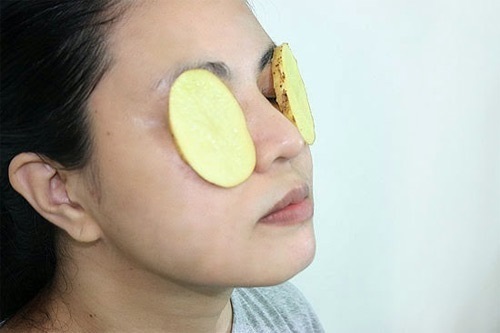 Mẹo làm trắng da, trị mụn siêu nhanh với khoai tây
