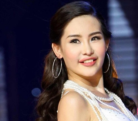 Lộ hình ảnh mới chứng minh Hoa hậu Đại dương từng chỉnh răng như lời tố của Nguyễn Thị Thành - Ảnh 4