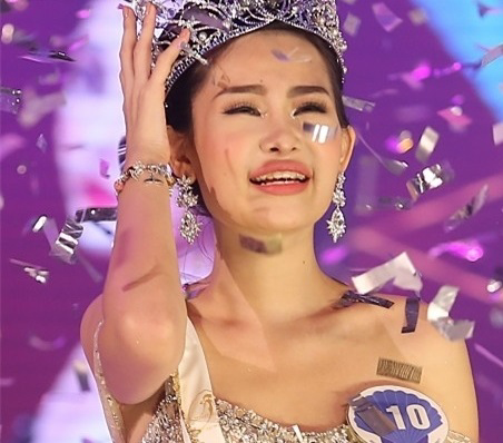 Lộ hình ảnh mới chứng minh Hoa hậu Đại dương từng chỉnh răng như lời tố của Nguyễn Thị Thành - Ảnh 5