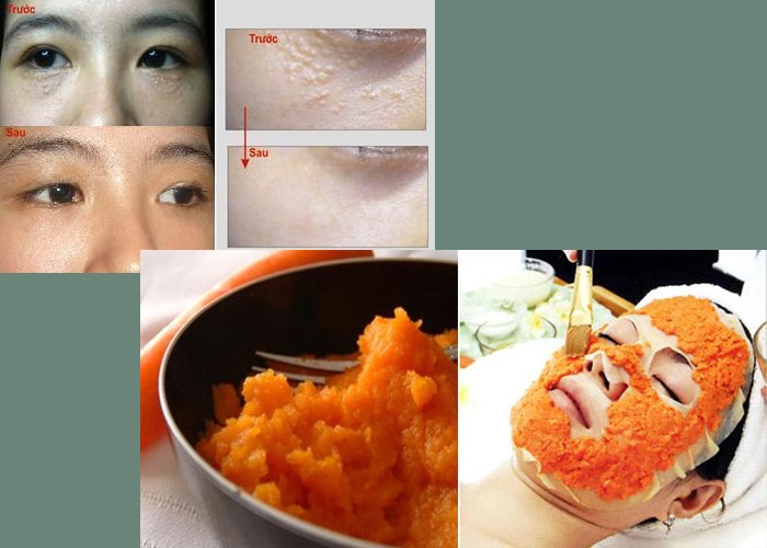 Lạ lùng với mẹo trị mụn thịt dân gian mang lại “phép màu” cho làn da - Ảnh 2 Mẹo trị mụn thịt dân gian bằng cà rốt