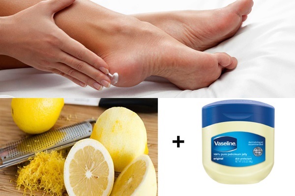 Mẹo trị nứt gót chân đơn giản và hiệu quả từ vaseline và chanh