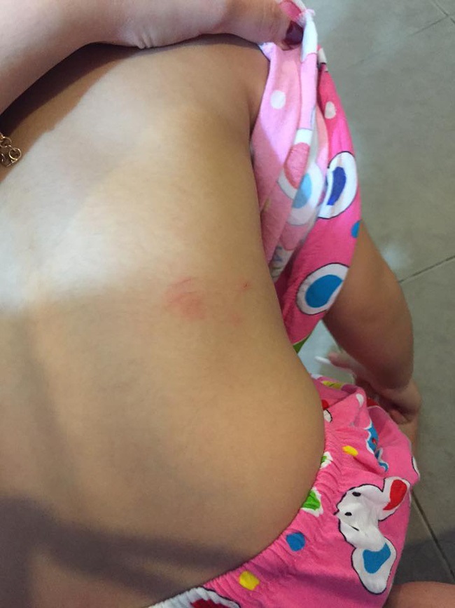 Phụ huynh bức xúc tố cô giáo trường MN quốc tế đánh con gái 3 tuổi trầy xước khắp người - Ảnh 2