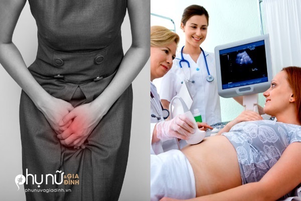 Đây là điều bác sĩ phụ khoa muốn mọi phụ nữ biết trước khi đi khám - Ảnh 1 Đây là điều bác sĩ phụ khoa muốn mọi phụ nữ biết trước khi đi khám - Ảnh 1