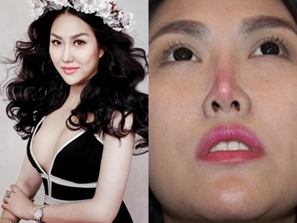 Những sao Việt ‘dọa’ khán giả vì gương mặt khác lạ khi phẫu thuật thẩm mỹ hỏng - Ảnh 8