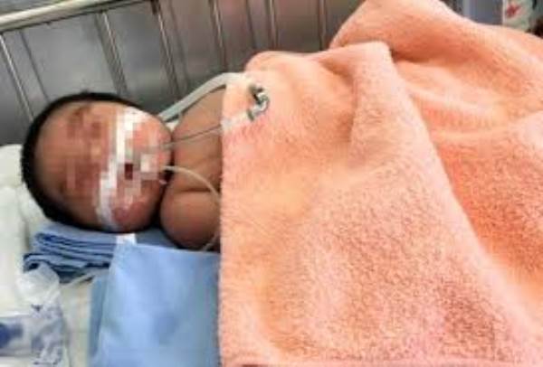 Em bé sơ sinh 3 ngày tuổi nguy kịch vì bị nhân viên y tế vặn gãy chân khi khóc nhiều - Ảnh 1