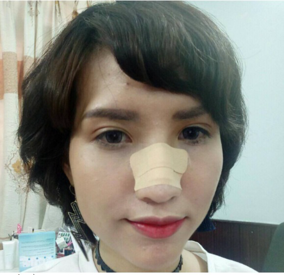 Thực hư chuyện Hồng Xuân rời Vietnam’s Next Top Model vì bị đánh gãy mũi tại nhà chung - Ảnh 6