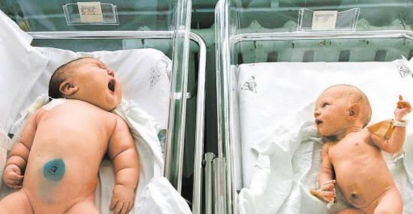 Bé trai sơ sinh 7,1 kg nặng nhất Việt Nam: Đó chưa phải là kỷ lục, nhìn qua những trường hợp này sẽ còn sửng sốt hơn - Ảnh 6