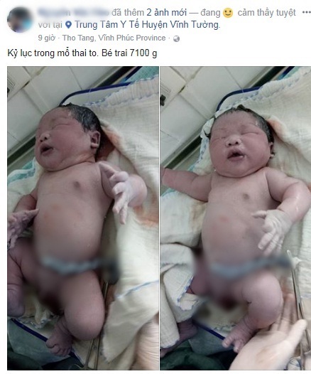 Bé trai sơ sinh 7,1 kg nặng nhất Việt Nam: Đó chưa phải là kỷ lục, nhìn qua những trường hợp này sẽ còn sửng sốt hơn - Ảnh 1