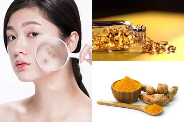 Chỉ 10 phút mỗi ngày trị mụn thâm bằng vitamin E đánh bay vết mụn nhanh nhất - Ảnh 4 Da sáng mịn, diệt sạch mụn thâm bằng vitamin E và bột nghệ