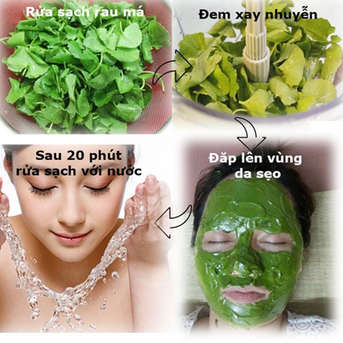 Các bước thực hiện trị sẹo lồi bằng rau má. Các bước thực hiện trị sẹo lồi bằng rau má.