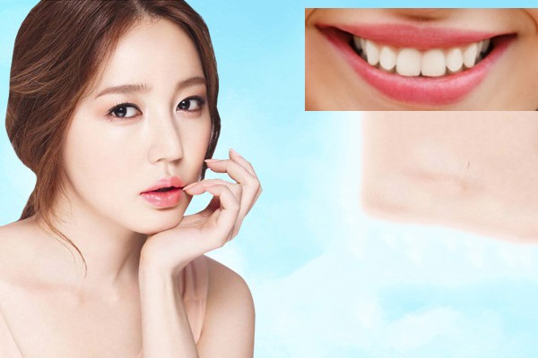 Trị sẹo lồi ở môi cần điều trị càng sớm càng tốt. Trị sẹo lồi ở môi cần điều trị càng sớm càng tốt.