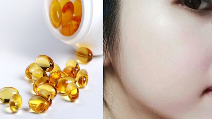 Trị sẹo thâm mụn bằng vitamin e giúp da đẹp trắng hồng rạng rỡ - Ảnh 2 Cách trị sẹo thâm mụn bằng vitamin E nguyên chất