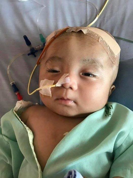 Em bé não úng thuỷ bị bỏ rơi trước cổng chùa đã ngưng thuốc, không còn khả năng phẫu thuật tại Singapore - Ảnh 1
